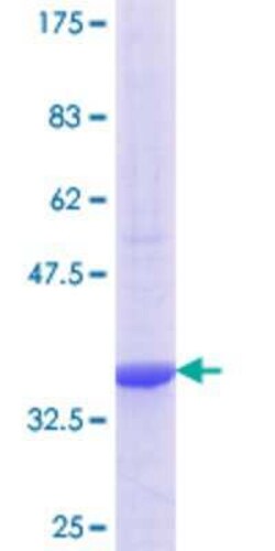 Novus Biologicals Recombinant Human PEX16 GST (N-Term) Protein 25 &mu;g | Buy Online | Novus Biologicals&trade; | Fisher Scientific
