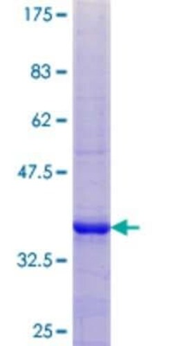 Novus Biologicals Recombinant Human WDR57 GST (N-Term) Protein 25 &mu;g | Buy Online | Novus Biologicals&trade; | Fisher Scientific