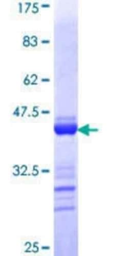 Novus Biologicals Recombinant Human Tight Junction Protein 2 GST (N-Term) Protein 10 &mu;g | Buy Online | Novus Biologicals&trade; | Fisher Scientific