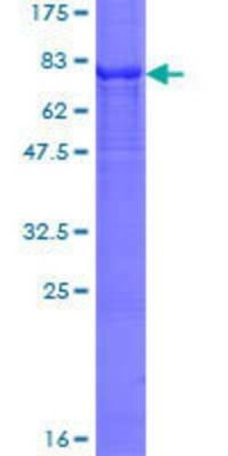 Novus Biologicals Recombinant Human CYP7B1 GST (N-Term) Protein 25 &mu;g | Buy Online | Novus Biologicals&trade; | Fisher Scientific