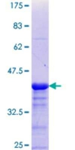 Novus Biologicals Recombinant Human CDYL GST (N-Term) Protein 10 &mu;g | Buy Online | Novus Biologicals&trade; | Fisher Scientific
