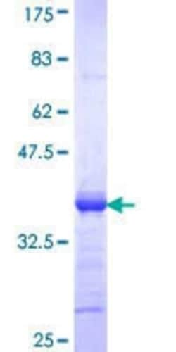 Novus Biologicals Recombinant Human CDY2A GST (N-Term) Protein 25 &mu;g | Buy Online | Novus Biologicals&trade; | Fisher Scientific