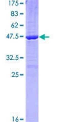 Novus Biologicals Recombinant Human ABCG2/CD338 GST (N-Term) Protein 10 &mu;g | Buy Online | Novus Biologicals&trade; | Fisher Scientific
