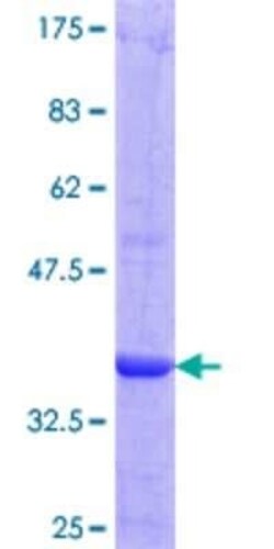 Novus Biologicals Recombinant Human ABCG2/CD338 GST (N-Term) Protein 25 &mu;g | Buy Online | Novus Biologicals&trade; | Fisher Scientific