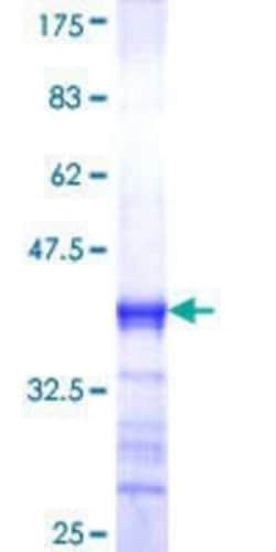 Novus Biologicals Recombinant Human MED23 GST (N-Term) Protein 10 &mu;g | Buy Online | Novus Biologicals&trade; | Fisher Scientific