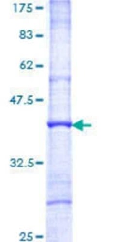 Novus Biologicals Recombinant Human ITM2B GST (N-Term) Protein 25 &mu;g | Buy Online | Novus Biologicals&trade; | Fisher Scientific