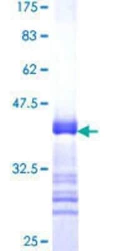 Novus Biologicals Recombinant Human PERK GST (N-Term) Protein 10 &mu;g | Buy Online | Novus Biologicals&trade; | Fisher Scientific