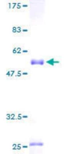 Novus Biologicals Recombinant Human FHL5 GST (N-Term) Protein 25 &mu;g | Buy Online | Novus Biologicals&trade; | Fisher Scientific