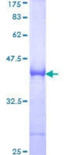 Novus Biologicals Recombinant Human SH3BP5 GST (N-Term) Protein 25 &mu;g | Buy Online | Novus Biologicals&trade; | Fisher Scientific