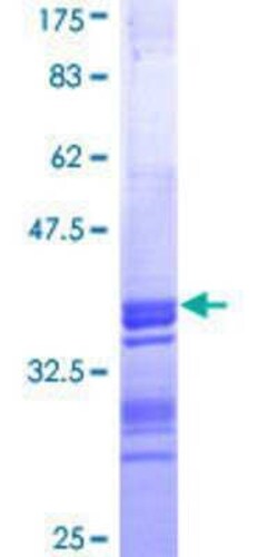 Novus Biologicals Recombinant Human PCYT1B GST (N-Term) Protein 10 &mu;g | Buy Online | Novus Biologicals&trade; | Fisher Scientific