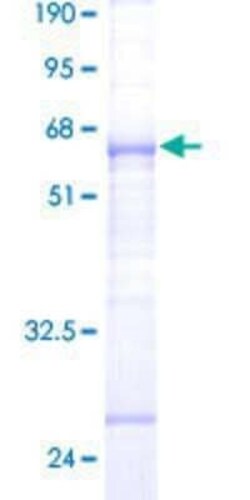 Novus Biologicals Recombinant Human EIF4E2 GST (N-Term) Protein 25 &mu;g | Buy Online | Novus Biologicals&trade; | Fisher Scientific