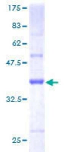 Novus Biologicals Recombinant Human ICB1 GST (N-Term) Protein 25 &mu;g | Buy Online | Novus Biologicals&trade; | Fisher Scientific