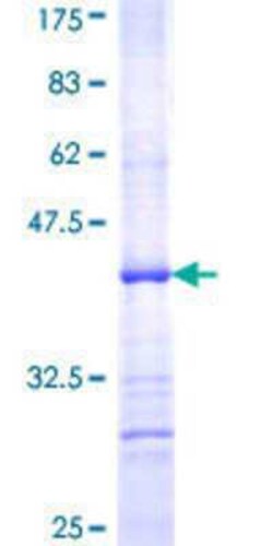Novus Biologicals Recombinant Human PIGL GST (N-Term) Protein 10 &mu;g | Buy Online | Novus Biologicals&trade; | Fisher Scientific