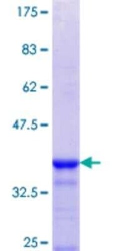 Novus Biologicals Recombinant Human AKAP5 GST (N-Term) Protein 10 &mu;g | Buy Online | Novus Biologicals&trade; | Fisher Scientific
