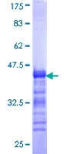 Novus Biologicals Recombinant Human SLC4A8 GST (N-Term) Protein 25 &mu;g | Buy Online | Novus Biologicals&trade; | Fisher Scientific