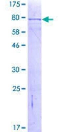 Novus Biologicals Recombinant Human Myotilin GST (N-Term) Protein 2 &mu;g | Buy Online | Novus Biologicals&trade; | Fisher Scientific