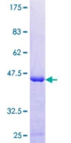 Novus Biologicals Recombinant Human XAGE2 GST (N-Term) Protein 10 &mu;g | Buy Online | Novus Biologicals&trade; | Fisher Scientific