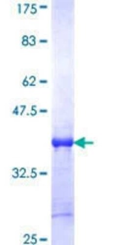 Novus Biologicals Recombinant Human XAGE2 GST (N-Term) Protein 25 &mu;g | Buy Online | Novus Biologicals&trade; | Fisher Scientific