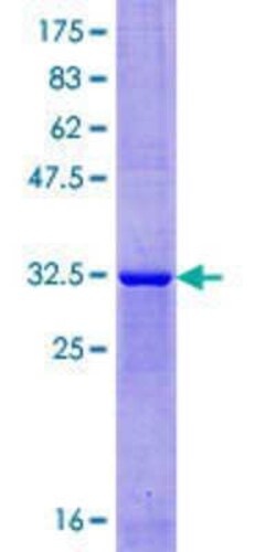 Novus Biologicals Recombinant Human XAGE1D GST (N-Term) Protein 10 &mu;g | Buy Online | Novus Biologicals&trade; | Fisher Scientific