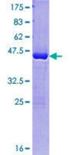 Novus Biologicals Recombinant Human PAGE4 GST (N-Term) Protein 10 &mu;g | Buy Online | Novus Biologicals&trade; | Fisher Scientific