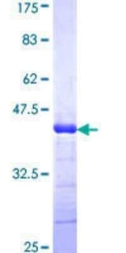 Novus Biologicals Recombinant Human ADAMTS2 GST (N-Term) Protein 25 &mu;g | Buy Online | Novus Biologicals&trade; | Fisher Scientific