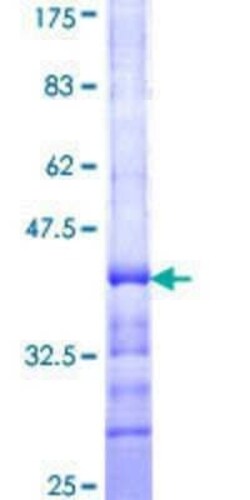 Novus Biologicals Recombinant Human GAL3ST1 GST (N-Term) Protein 10 &mu;g | Buy Online | Novus Biologicals&trade; | Fisher Scientific