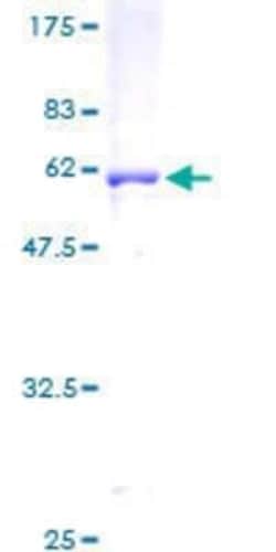 Novus Biologicals Recombinant Human SCAMP1 GST (N-Term) Protein 2 &mu;g | Buy Online | Novus Biologicals&trade; | Fisher Scientific