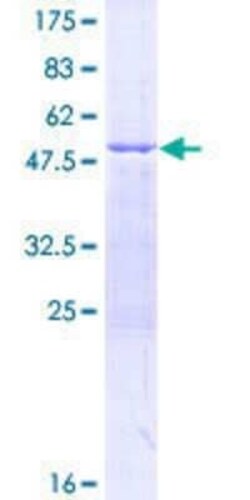 Novus Biologicals Recombinant Human GOSR1 GST (N-Term) Protein 2 &mu;g | Buy Online | Novus Biologicals&trade; | Fisher Scientific