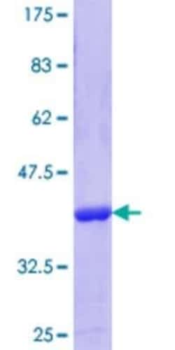 Novus Biologicals Recombinant Human GOSR1 GST (N-Term) Protein 10 &mu;g | Buy Online | Novus Biologicals&trade; | Fisher Scientific