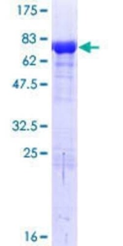 Novus Biologicals Recombinant Human BAG5 GST (N-Term) Protein 10 &mu;g | Buy Online | Novus Biologicals&trade; | Fisher Scientific