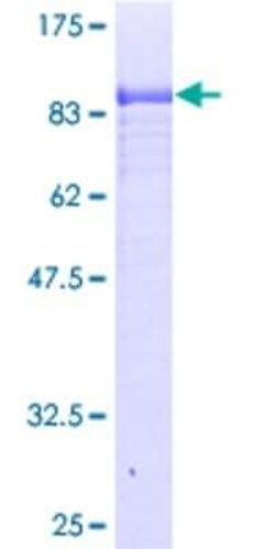 Novus Biologicals Recombinant Human SODD/BAG4 GST (N-Term) Protein 10 &mu;g | Buy Online | Novus Biologicals&trade; | Fisher Scientific