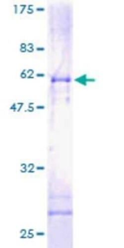 Novus Biologicals Recombinant Human EI24 GST (N-Term) Protein 2 &mu;g | Buy Online | Novus Biologicals&trade; | Fisher Scientific