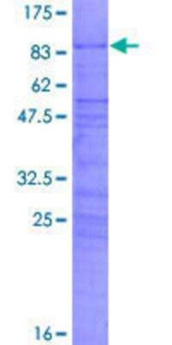 Novus Biologicals Recombinant Human CBF1-interacting corepressor GST (N-Term) Protein 2 &mu;g | Buy Online | Novus Biologicals&trade; | Fisher Scientific