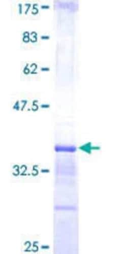 Novus Biologicals Recombinant Human CBF1-interacting corepressor GST (N-Term) Protein 10 &mu;g | Buy Online | Novus Biologicals&trade; | Fisher Scientific
