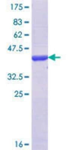 Novus Biologicals Recombinant Human IGDCC3 GST (N-Term) Protein 25 &mu;g | Buy Online | Novus Biologicals&trade; | Fisher Scientific