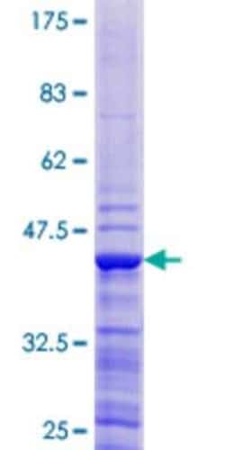 Novus Biologicals Recombinant Human ATP6V1G1 GST (N-Term) Protein 25 &mu;g | Buy Online | Novus Biologicals&trade; | Fisher Scientific