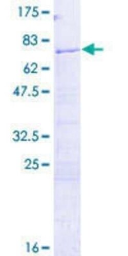 Novus Biologicals Recombinant Human Histone H2AY/macroH2A.1 GST (N-Term) Protein 2 &mu;g | Buy Online | Novus Biologicals&trade; | Fisher Scientific