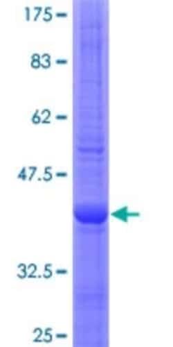 Novus Biologicals Recombinant Human Glucose 1-dehydrogenase GST (N-Term) Protein 10 &mu;g | Buy Online | Novus Biologicals&trade; | Fisher Scientific