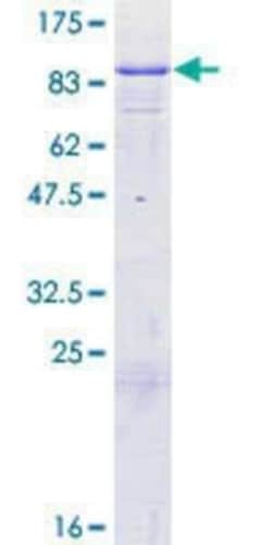 Novus Biologicals Recombinant Human GTP-binding protein 1 GST (N-Term) Protein 25 &mu;g | Buy Online | Novus Biologicals&trade; | Fisher Scientific