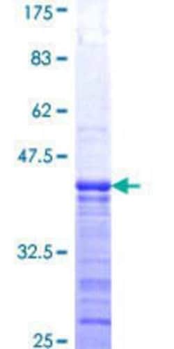 Novus Biologicals Recombinant Human GTP-binding protein 1 GST (N-Term) Protein 25 &mu;g | Buy Online | Novus Biologicals&trade; | Fisher Scientific