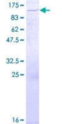 Novus Biologicals Recombinant Human SOX13 GST (N-Term) Protein 2 &mu;g | Buy Online | Novus Biologicals&trade; | Fisher Scientific