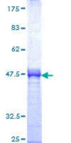 Novus Biologicals Recombinant Human SOX13 GST (N-Term) Protein 10 &mu;g | Buy Online | Novus Biologicals&trade; | Fisher Scientific