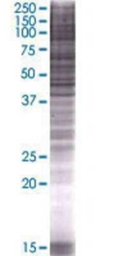 Novus Biologicals APOBEC3B 293T Cell Transient Overexpression Lysate 0.1 mL | Buy Online | Novus Biologicals&trade; | Fisher Scientific