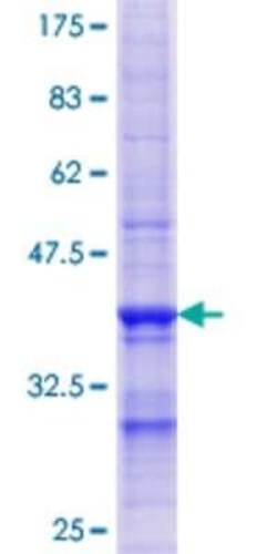 Novus Biologicals Recombinant Human ENTPD4 GST (N-Term) Protein 10 &mu;g | Buy Online | Novus Biologicals&trade; | Fisher Scientific