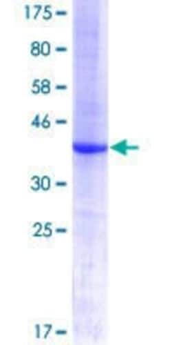Novus Biologicals Recombinant Human MPHOSPH1 GST (N-Term) Protein 10 &mu;g | Buy Online | Novus Biologicals&trade; | Fisher Scientific
