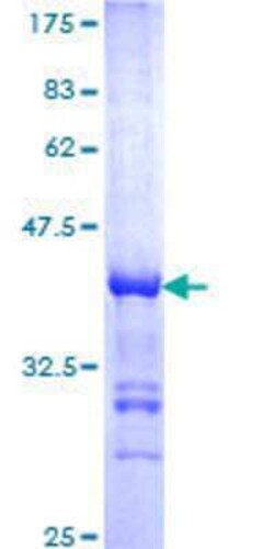 Novus Biologicals Recombinant Human CREB5 GST (N-Term) Protein 25 &mu;g | Buy Online | Novus Biologicals&trade; | Fisher Scientific