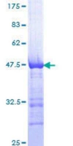 Novus Biologicals Recombinant Human AKAP12 GST (N-Term) Protein 10 &mu;g | Buy Online | Novus Biologicals&trade; | Fisher Scientific