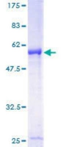 Novus Biologicals Recombinant Human IER2 GST (N-Term) Protein 25 &mu;g | Buy Online | Novus Biologicals&trade; | Fisher Scientific