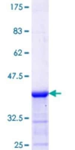 Novus Biologicals Recombinant Human NIR2 GST (N-Term) Protein 10 &mu;g | Buy Online | Novus Biologicals&trade; | Fisher Scientific