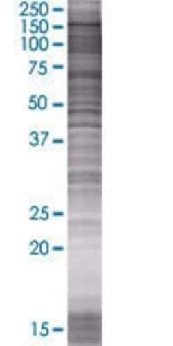 Novus Biologicals&trade;&nbsp;NIR2 293T Cell Transient Overexpression Lysate